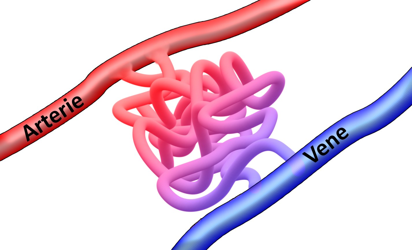 Arteriovenöse Malformation